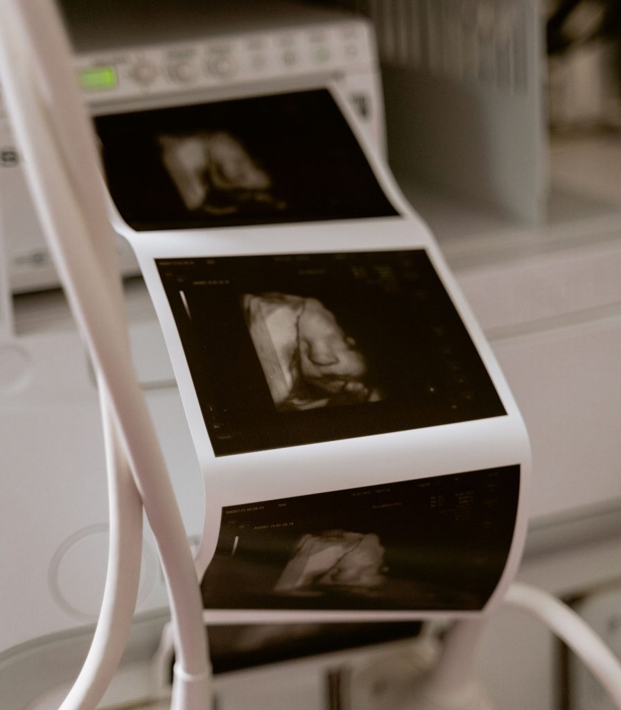 Ultrasound scan printouts from a medical machine in a clinic environment, showcasing modern diagnostic technology.